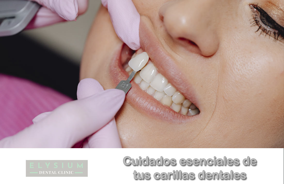 Cuidados de las carillas