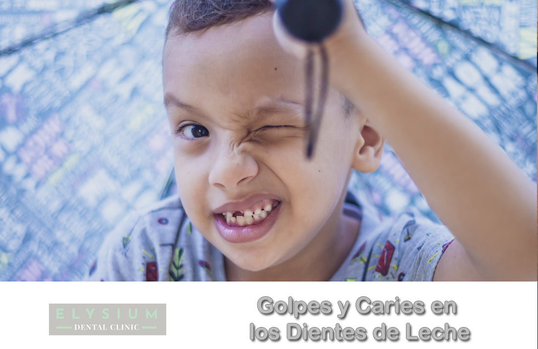 Golpes y caries en los dientes de leche