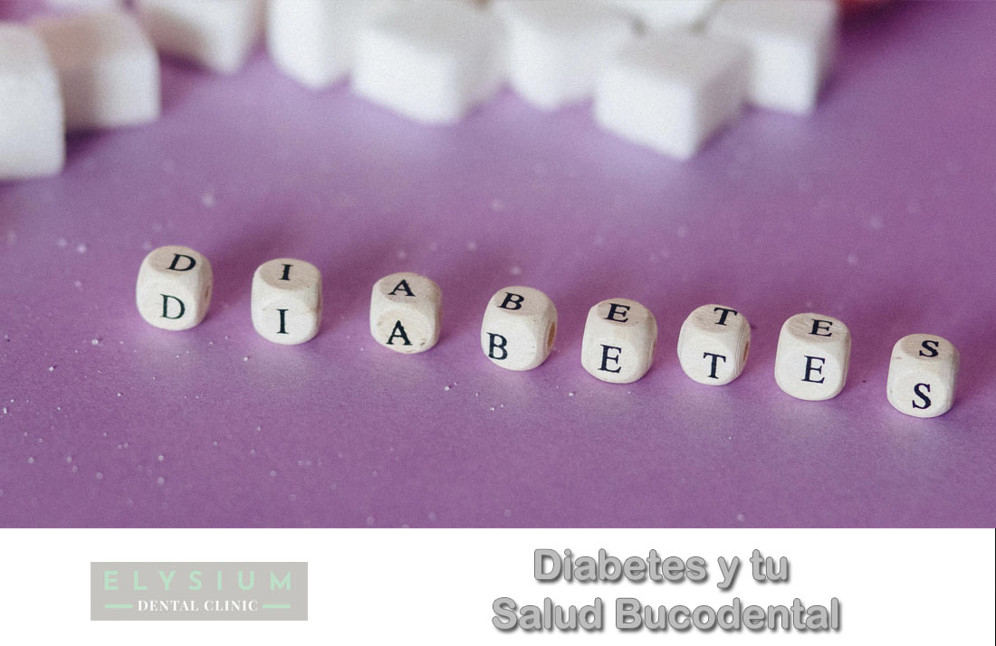 Como afecta la diabetes a tu boca