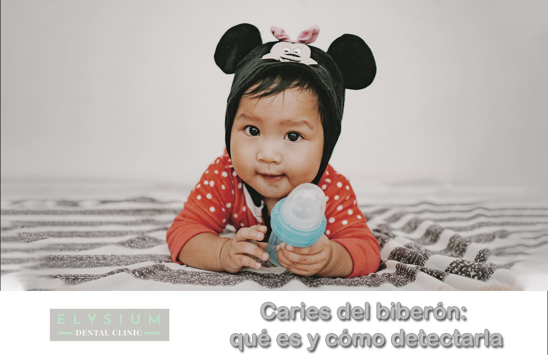 Caries del biberón