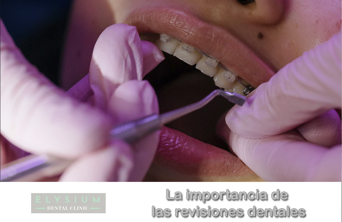 La importancia de las revisiones dentales periódicas