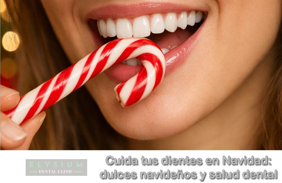 cuidados dentales en navidad