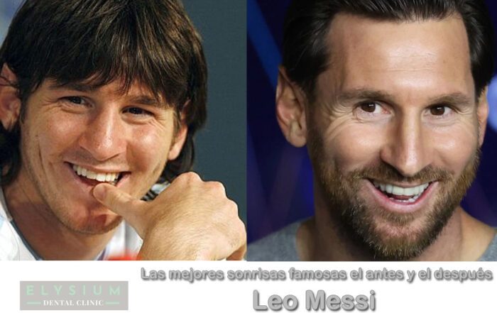 El cambio de la sonrisa de Leo Messi