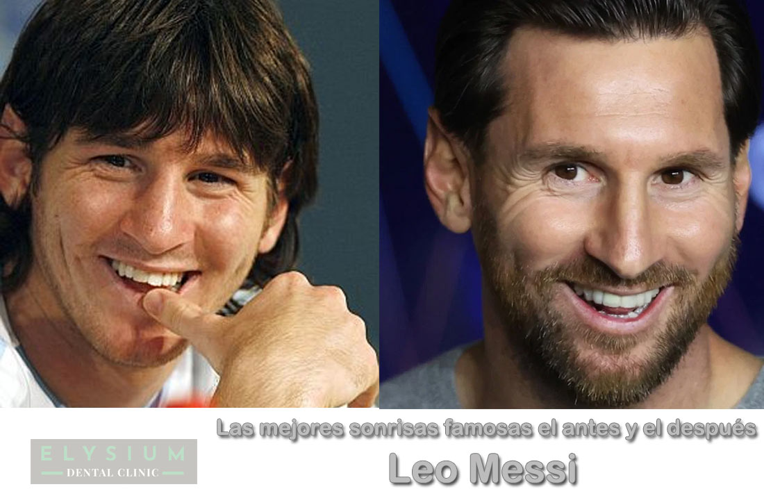 El cambio de la sonrisa de Leo Messi