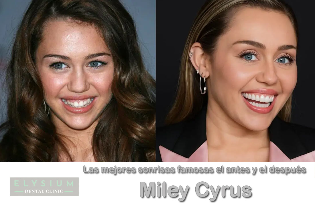 La sonrisa de Miley Cyrus