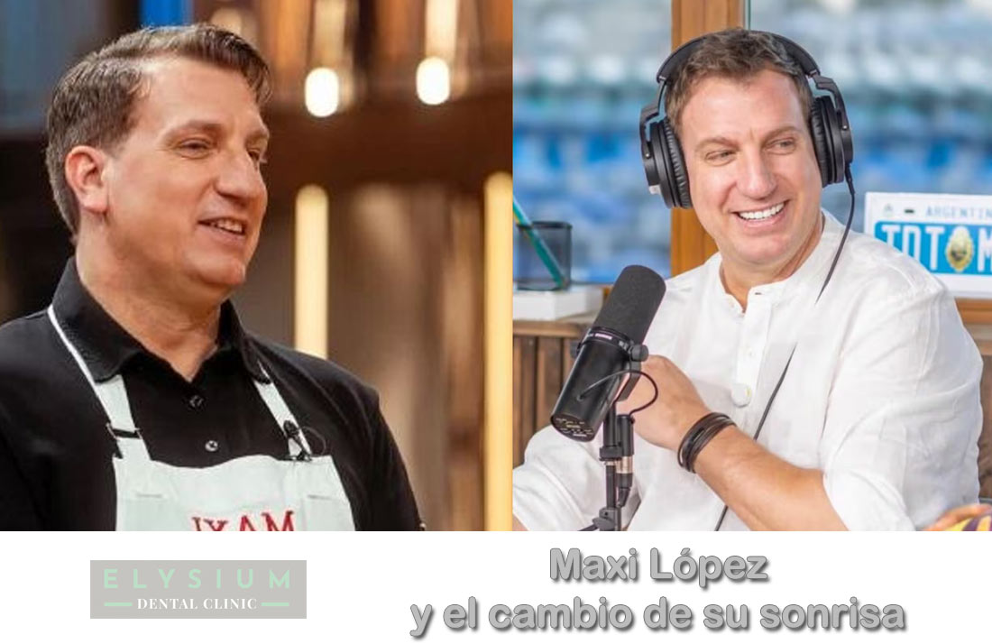 La transformación dental de Maxi López