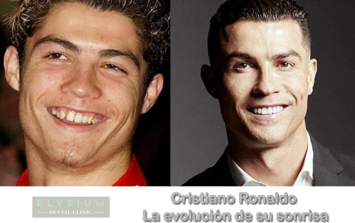 la evolucion de la sonrisa de cristiano ronaldo